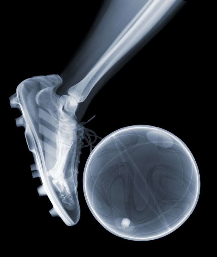 Foto: Nick Veasey