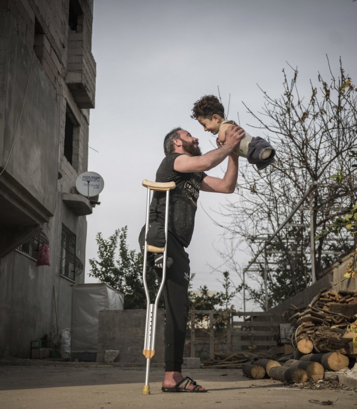 Foto emocionante do pai segurando o filho vence concurso internacional de fotografia. Foto: Mehmet Aslan