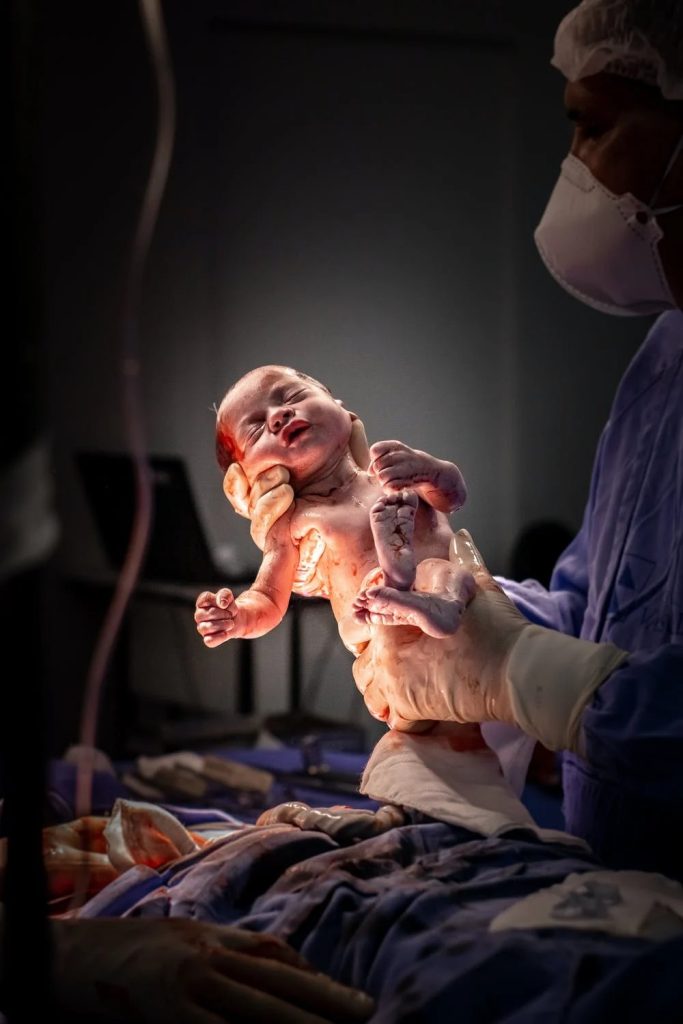 Hospitais podem proibir fotógrafos na sala de parto?