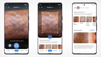 Google Lens agora pode identificar problemas de pele a partir de uma foto